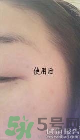 dr.jart適合什么年齡層？蒂佳婷適合年齡