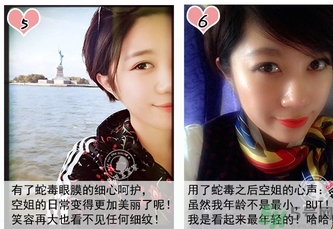 蛇毒眼膜孕婦可以用嗎？ 日本spa蛇毒眼膜孕婦能用嗎？