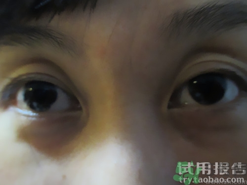 蛇毒眼膜效果怎么樣？spa蛇毒眼膜紅色好用嗎？