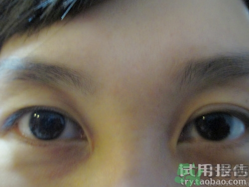 蛇毒眼膜效果怎么樣？spa蛇毒眼膜紅色好用嗎？