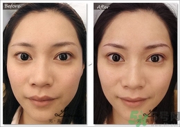 眉毛怎么整形好看？眉毛怎么整自然？