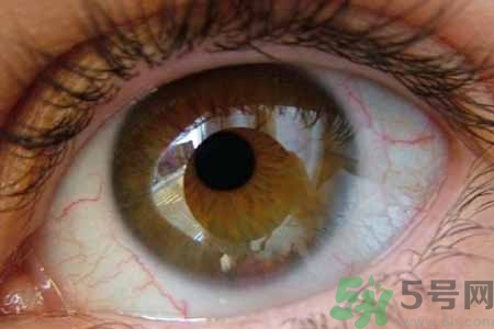 ?干眼癥的治療方法是什么？如何預(yù)防干眼癥？