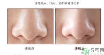 yu.r巧克力棒鼻貼怎么樣？yu.r巧克力鼻貼好用嗎？