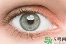 黑眼圈是怎么形成的？黑眼圈是什么原因引起的？