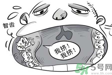智齒拔了好不好？智齒能不拔嗎？