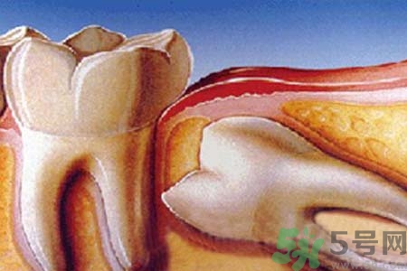 拔智齒一顆多少錢？拔除智齒收費(fèi)多少？
