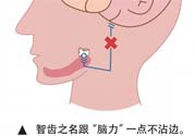 長智齒疼痛怎么辦？長智齒牙齦腫了怎么辦？