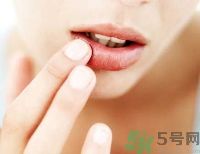 孕婦嘴唇干裂脫皮怎么回事？孕婦嘴唇干裂脫皮是缺什么