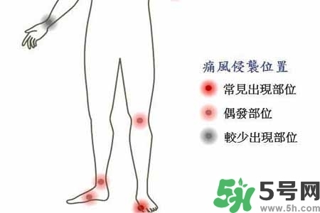 引發(fā)痛風的原因是什么？痛風病人飲食需注意什么好？