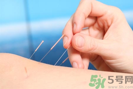 針灸一次要扎多長時間？針灸可以幾天做一次？