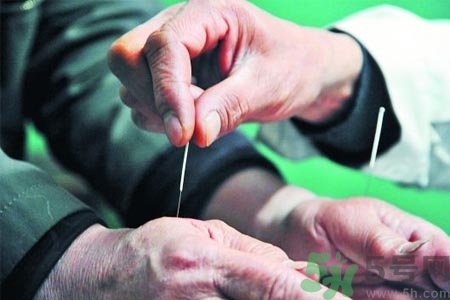 針灸一次要扎多長時間？針灸可以幾天做一次？