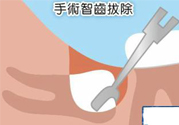 智齒拔完后有個洞怎么辦？拔智齒后有個洞多久能長好？