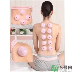 在家拔罐需要注意什么？在家拔罐幾天拔一次？