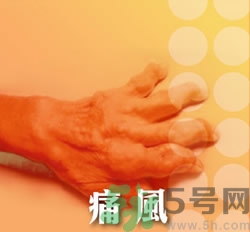 骨關(guān)節(jié)炎能治好嗎？骨關(guān)節(jié)炎平時(shí)注意事項(xiàng)
