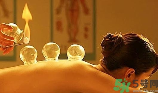 在家拔罐需要注意什么？在家拔罐幾天拔一次？