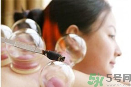 肩膀酸痛可以拔火罐嗎？孕婦肩膀酸痛能拔火罐嗎？