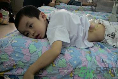 小孩可以拔罐嗎？寶寶能拔火罐嗎？