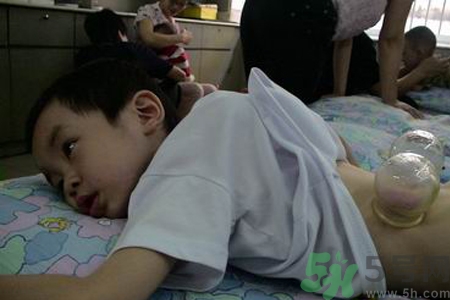 小孩可以拔罐嗎？寶寶能拔火罐嗎？