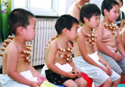 小孩可以拔罐嗎？寶寶能拔火罐嗎？