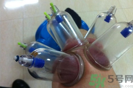 膝蓋能拔罐嗎？膝蓋疼可以拔罐嗎？