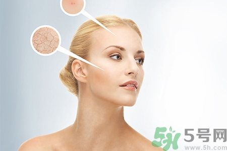 甘油會(huì)堵塞毛孔嗎？甘油堵塞毛孔怎么辦？