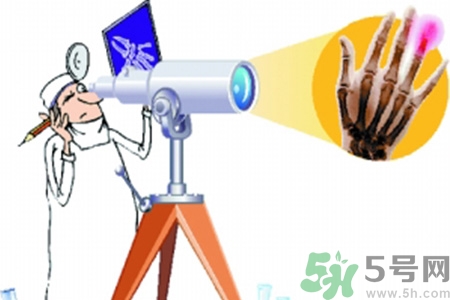 什么年齡測骨齡最好？如何測骨齡？