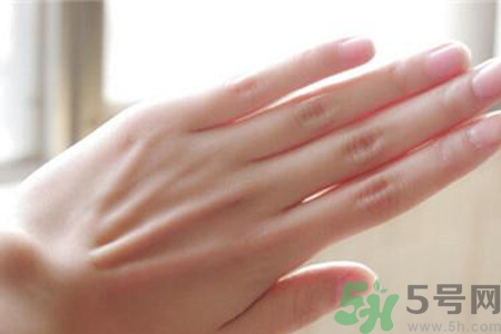 患凍瘡是身體缺什么嗎？長(zhǎng)凍瘡是身體缺維生素嗎？
