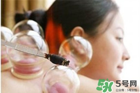 拔罐放血對(duì)身體好嗎？拔罐放血有什么好處？
