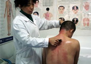 刮痧后什么顏色才健康？刮痧顏色反映的病癥