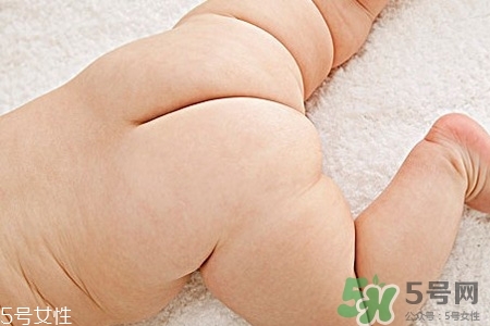 擴(kuò)肛有什么好處？擴(kuò)肛需要注意什么？