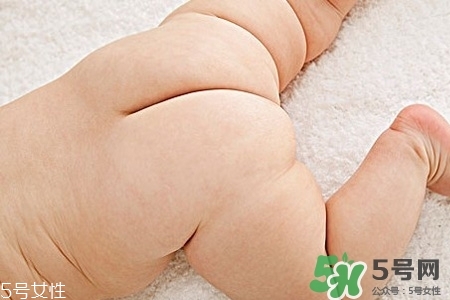 擴肛疼嗎？擴肛手術(shù)會很疼嗎？