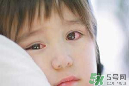 孩子為什么老眨眼睛？孩子總眨眼睛怎么回事？