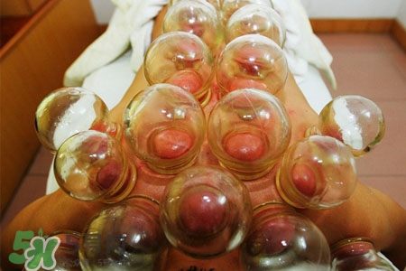 拔罐后皮膚發(fā)癢是怎么回事？拔罐后為什么皮膚會(huì)癢？