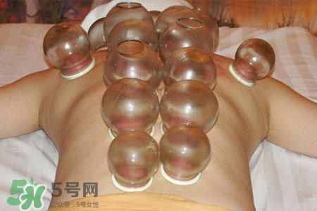 拔火罐后皮膚癢擦什么?拔火罐后皮膚癢怎么辦? 拔火罐后皮膚癢擦什么?拔火罐后皮膚癢怎么辦?