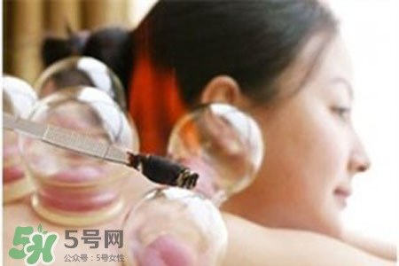 拔火罐后皮膚癢擦什么?拔火罐后皮膚癢怎么辦? 拔火罐后皮膚癢擦什么?拔火罐后皮膚癢怎么辦?