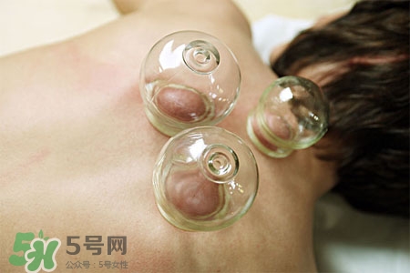 拔火罐后皮膚癢正常嗎？拔火罐后皮膚癢什么原因？
