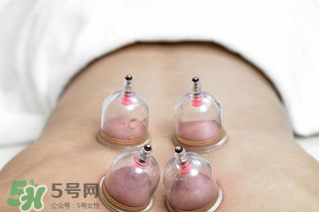 冬天拔罐好還是刮痧好？冬天刮痧和拔罐哪個效果好？