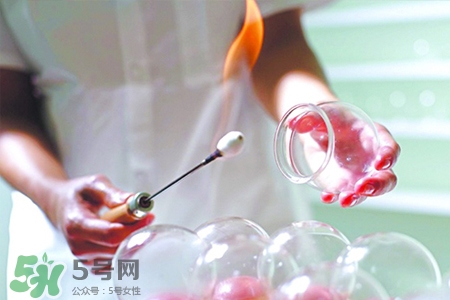 冬天拔罐后多久能洗澡？警惕冬季拔罐后不宜立即洗澡