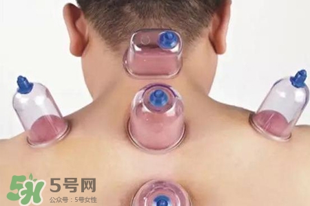 拔罐后可以喝酒嗎？拔罐后多久能喝酒？