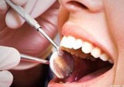 拔牙之后可以吃藥嗎？拔牙之后要不要吃藥？