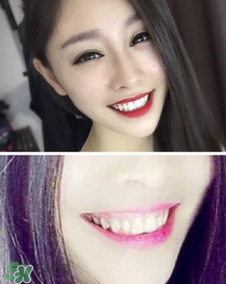 碧緹福冷光牙齒美白儀怎么用？碧緹福冷光牙齒美白儀使用方法