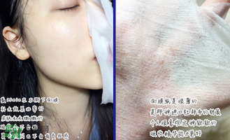 稚優(yōu)泉面膜怎么用？稚優(yōu)泉面膜要洗嗎？