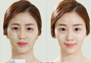 skin1004是什么牌子？skin1004屬于什么檔次