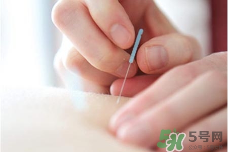 腰間盤突出可以針灸嗎？針灸能治腰間盤突出嗎？