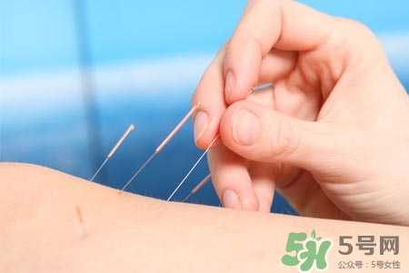 腰間盤突出可以針灸嗎？針灸能治腰間盤突出嗎？