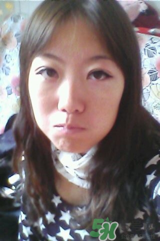 什么是定點(diǎn)雙眼皮？定點(diǎn)雙眼皮多少錢？