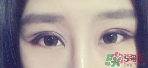 切開雙眼皮多久消腫？切開雙眼皮多久恢復(fù)？