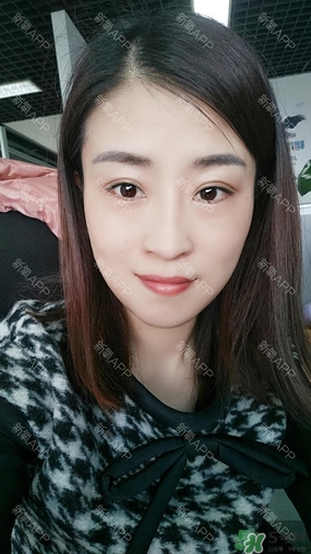 埋線雙眼皮能保持多久？埋線雙眼皮是永久嗎