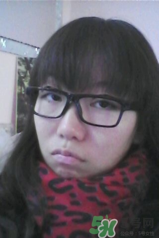 什么是定點(diǎn)雙眼皮？定點(diǎn)雙眼皮多少錢？