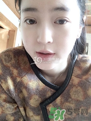 什么是定點(diǎn)雙眼皮？定點(diǎn)雙眼皮多少錢？